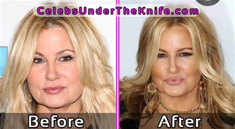 jennifer coolidge before plastic surgery|Plastic Surgery & Dermatology 